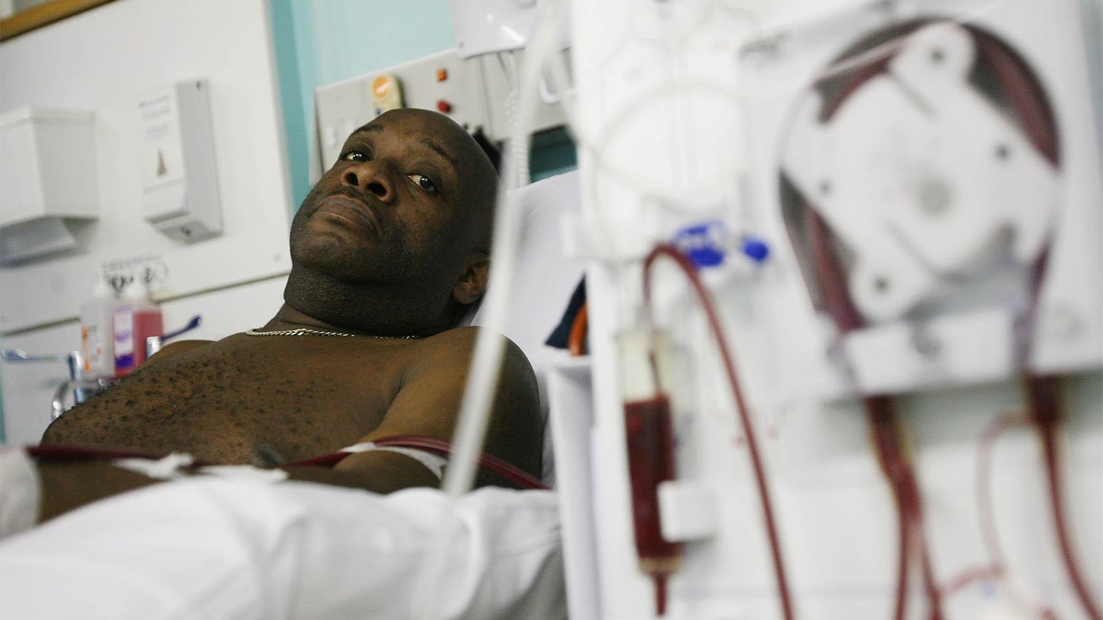 Dying While Waiting for Dialysis: Inside South Eastern Nigeria's Kidney Disease Challenge